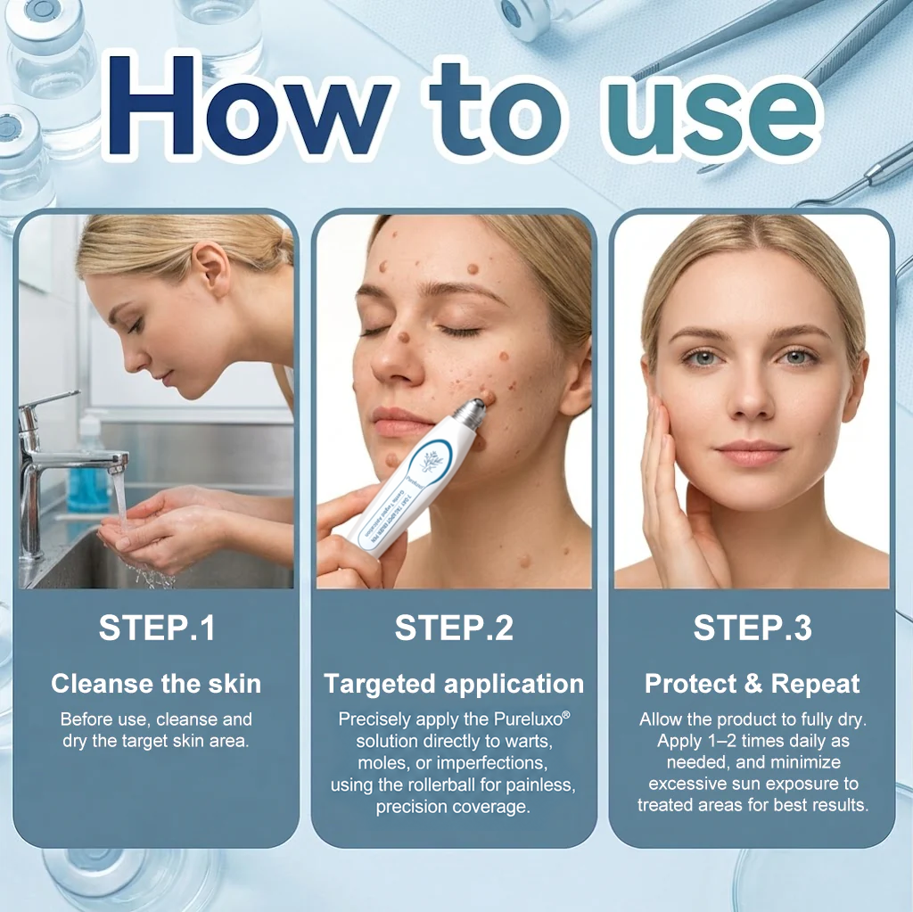 Pureluxo® Skin Tag Remover Roller💥💥💥