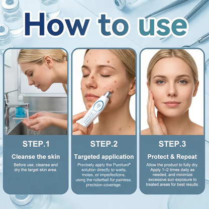 Pureluxo® Skin Tag Remover Roller💥💥💥