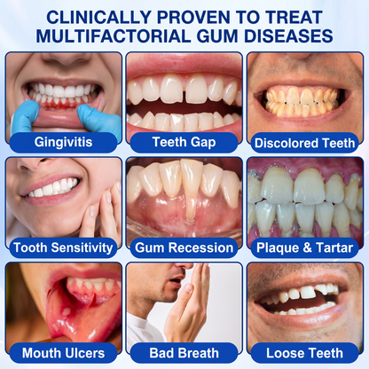 Pureluxo® 🦷GumRevive periodontal repair gel