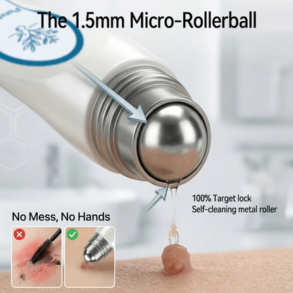 Pureluxo® Skin Tag Remover Roller💥💥💥