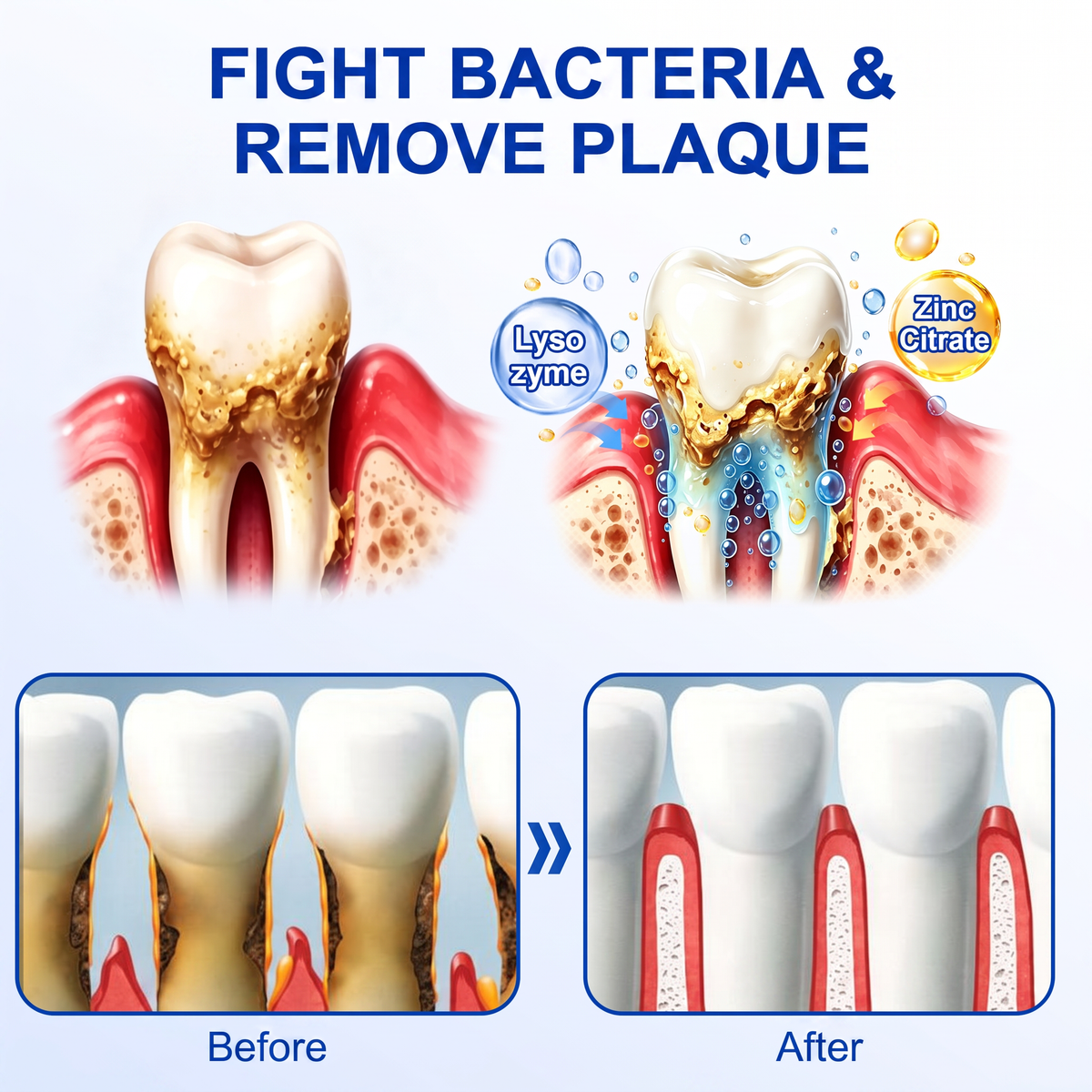 Pureluxo® 🦷GumRevive periodontal repair gel