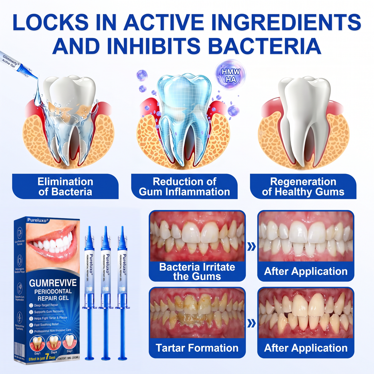 Pureluxo® 🦷GumRevive periodontal repair gel
