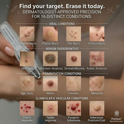 Pureluxo® Skin Tag Remover Roller💥💥💥