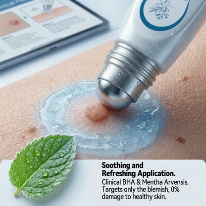 Pureluxo® Skin Tag Remover Roller💥💥💥